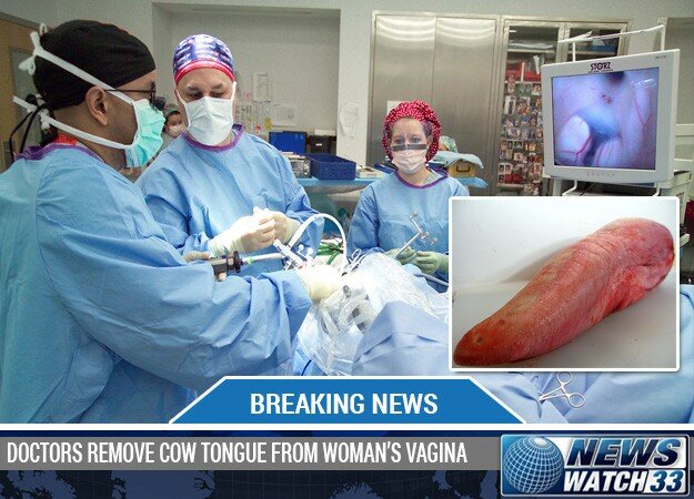 DOCTORS REMOVE COW TONGUE FROM WOMAN’S VAGINA